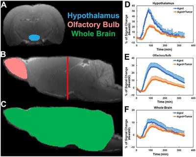 Glymphatic transport is reduced in rats with spontaneous pituitary tumor